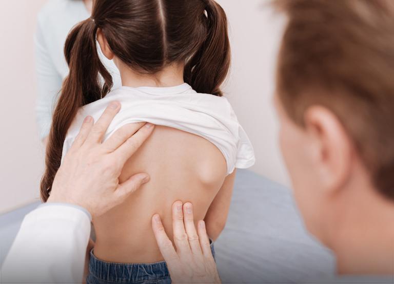 leczenie wad postawy