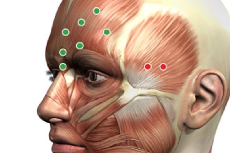 iniekcyjne terapie kolagenowe