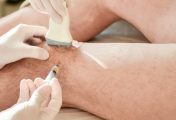 kwas hialuronowy kwas hialuronowy